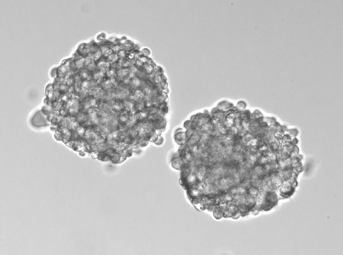 Lung cancer stem cells 