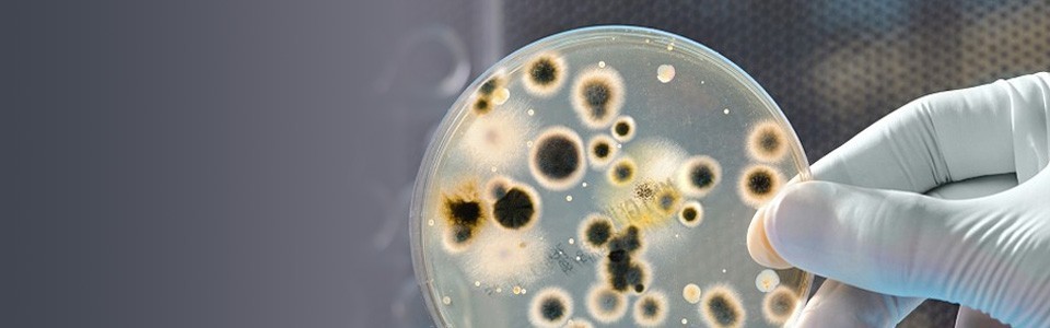 Gloved hand holding Petri dish with bacteria growing