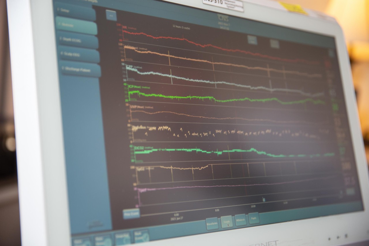 A monitor displays patient vital signs following a traumatic brain injury
